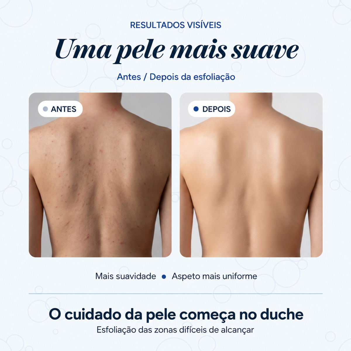 Toalha de banho esfoliante